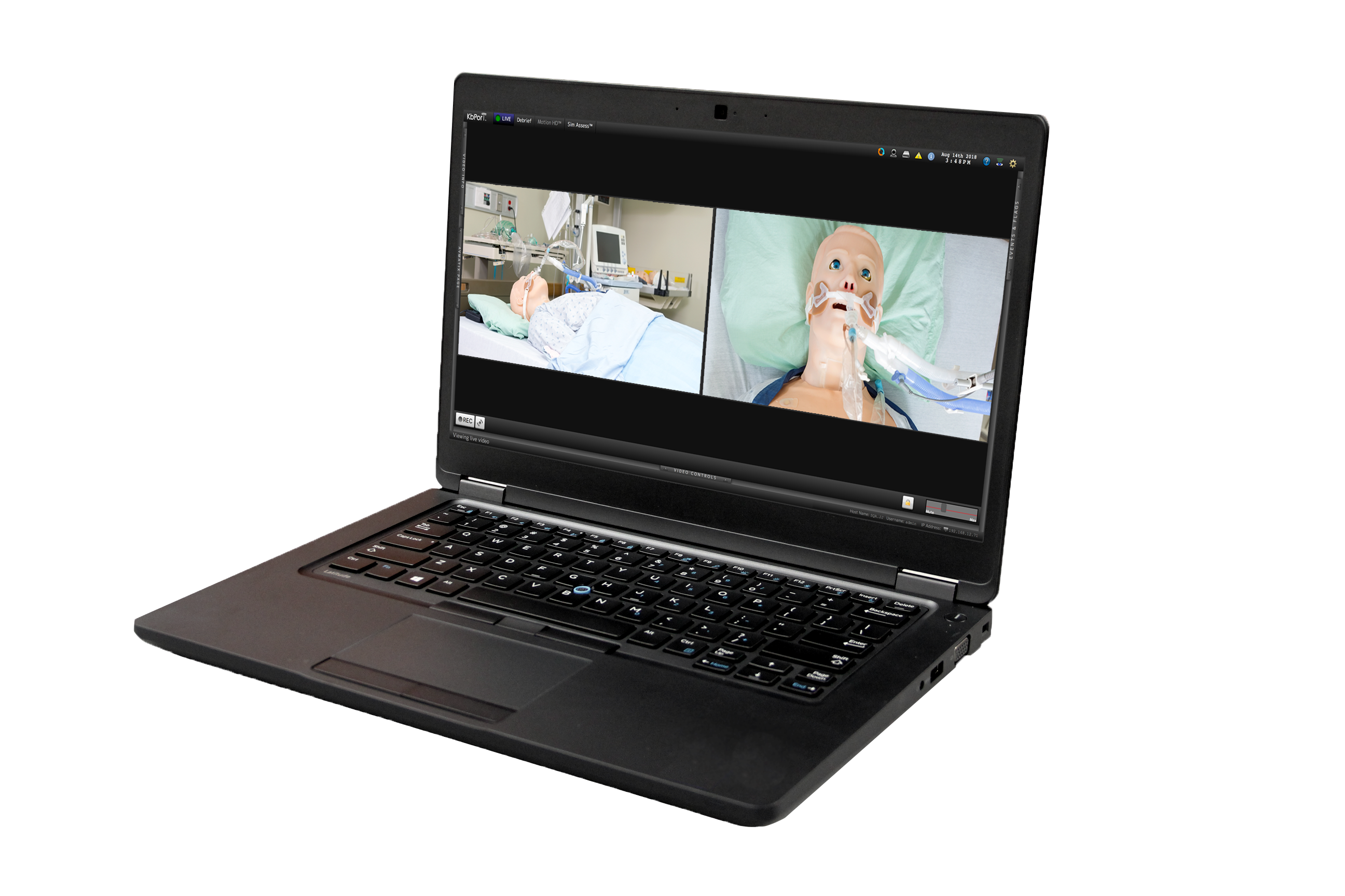 Laptop