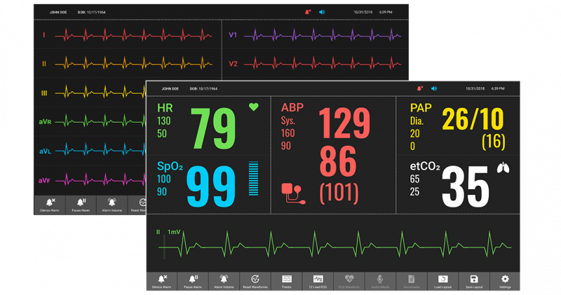 featured_product_patient-monitor