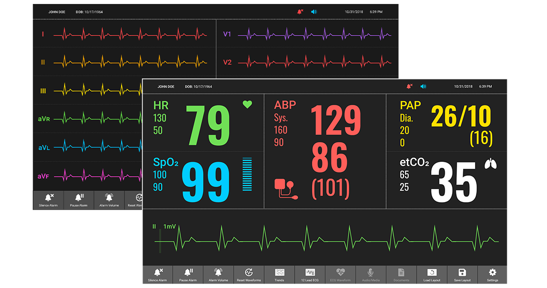 featured_product_patient-monitor